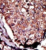AP15094PU-N - DAG kinase beta