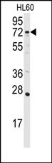 AP15096PU-N - DAG kinase alpha
