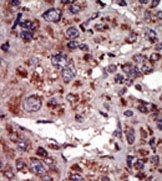 AP15096PU-N - DAG kinase alpha