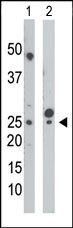 AP15097PU-N - CMPK1