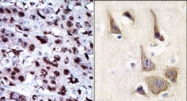 AP15100PU-N - Adenylate kinase 5 / AK5