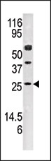 AP15104PU-N - Adenylate kinase 4 / AK4