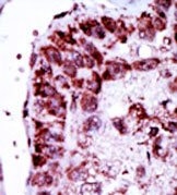 AP15108PU-N - Adenylate kinase 2 / AK2