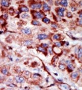 AP15109PU-N - Adenylate kinase 2 / AK2