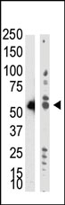 AP11029PU-N - DNMT2 / TRDMT1