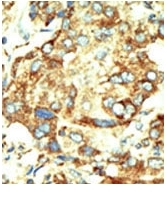 AP11029PU-N - DNMT2 / TRDMT1