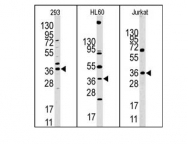 AP11042PU-N - HIF1AN / FIH1