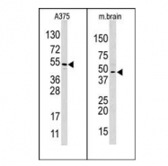 AP11043PU-N - HIF1AN / FIH1