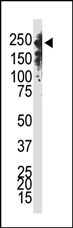 AP11047PU-N - DNMT1