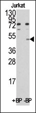AP11048PU-N - MYC-induced nuclear antigen