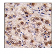 AP11048PU-N - MYC-induced nuclear antigen