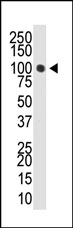 AP11049PU-N - DNMT3A