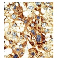 AP11049PU-N - DNMT3A