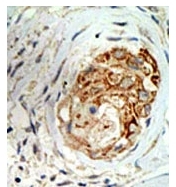 AP11059PU-N - MBD3