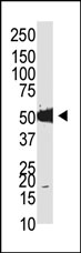 AP11072PU-N - DNMT2 / TRDMT1