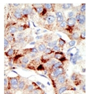 AP11072PU-N - DNMT2 / TRDMT1