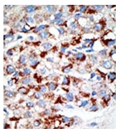 AP11076PU-N - UBA3 / UBE1C