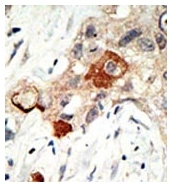 AP11077PU-N - UBC9 / UBE2I