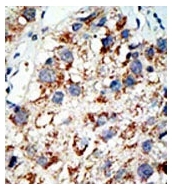AP11080PU-N - SAE2 / UBA2