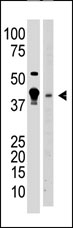 AP11082PU-N - MBD2