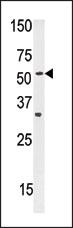 AP11116PU-N - SLC29A1 / ENT1