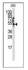 AP11118PU-N - SLC29A1 / ENT1