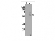 AP11120PU-N - SLC29A4 / ENT4