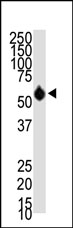 AP11136PU-N - HDAC8