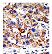 AP11136PU-N - HDAC8