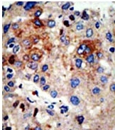 AP11138PU-N - HDAC9