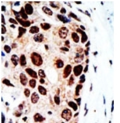 AP11139PU-N - HDAC9