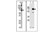 AP11140PU-N - HDAC10
