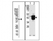 AP11142PU-N - HDAC11