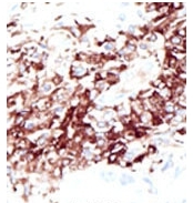 AP11142PU-N - HDAC11