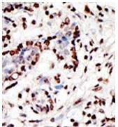 AP11157PU-N - MLL / HRX