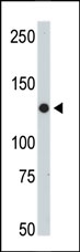 AP11160PU-N - Tyrosine-protein kinase JAK2