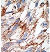 AP11162PU-N - ISG15 / G1P2