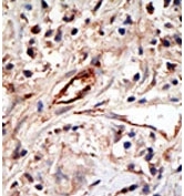 AP11163PU-N - ISG15 / G1P2