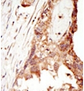 AP11206PU-N - PRDM14 / PFM11