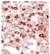 AP11224PU-N - SUMO2/3