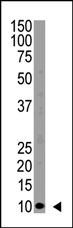 AP11229PU-N - Ubiquitin