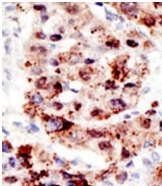 AP11230PU-N - Polyubiquitin-C / UBC