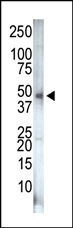 AP14970PU-N - PIP4K2C / PIP5K2C