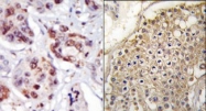 AP14970PU-N - PIP4K2C / PIP5K2C
