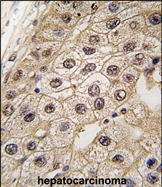 AP14986PU-N - EIF2AK3