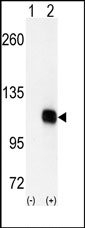 AP15003PU-N - DAG kinase zeta