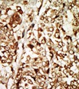 AP15016PU-N - MOS