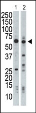 AP15034PU-N - Nrbp1