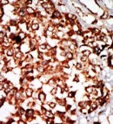 AP15034PU-N - Nrbp1