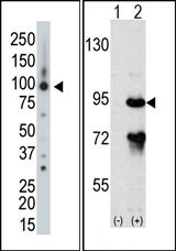 AP15036PU-N - ARHGAP26 / OPHN1L